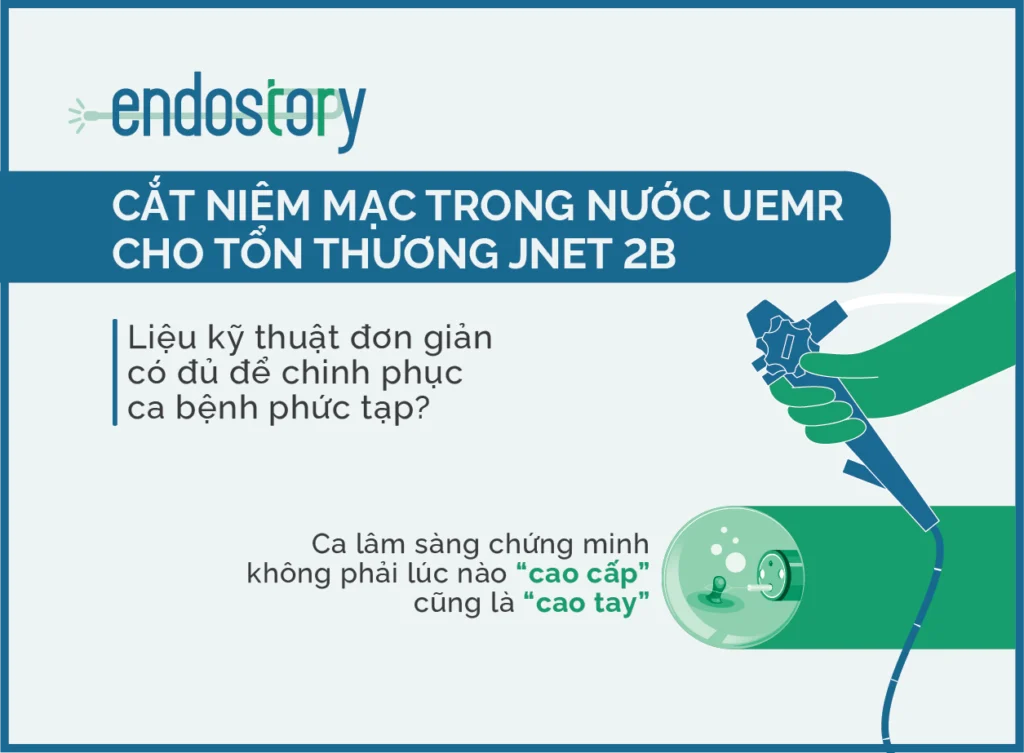 Endostory so 3