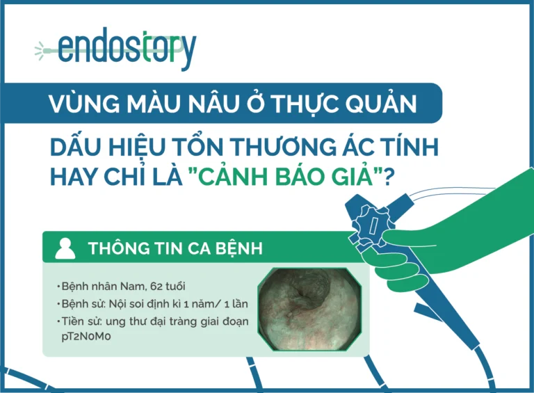 ENDOSTORY #8: BROWNISH AREA IN THE ESOPHAGUS – SIGN OF MALIGNANCY OR JUST A “FALSE ALARM”?