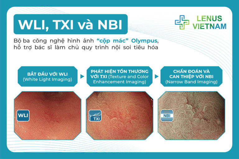 WLI, TXI và NBI: Bộ ba công nghệ hình ảnh “cộp mác” Olympus, hỗ trợ bác sĩ làm chủ quy trình nội soi tiêu hóa