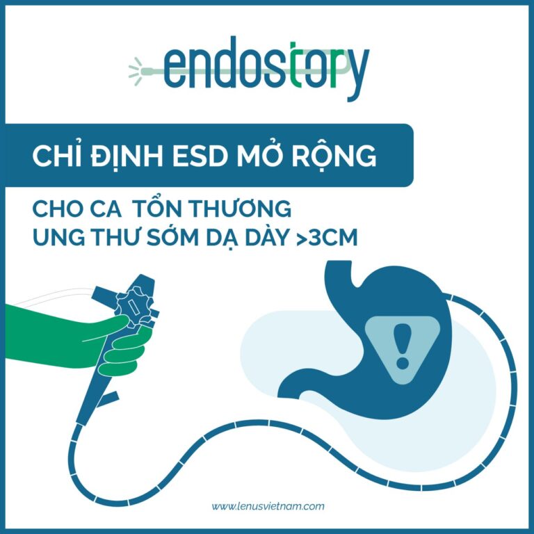 Endostory No.14: Chỉ định ESD mở rộng cho ca tổn thương ung thư sớm dạ dày kích thước lớn