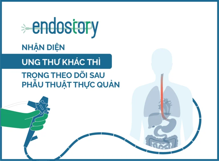 Endostory No.16: Nhận diện ung thư khác thì trong theo dõi sau phẫu thuật thực quản
