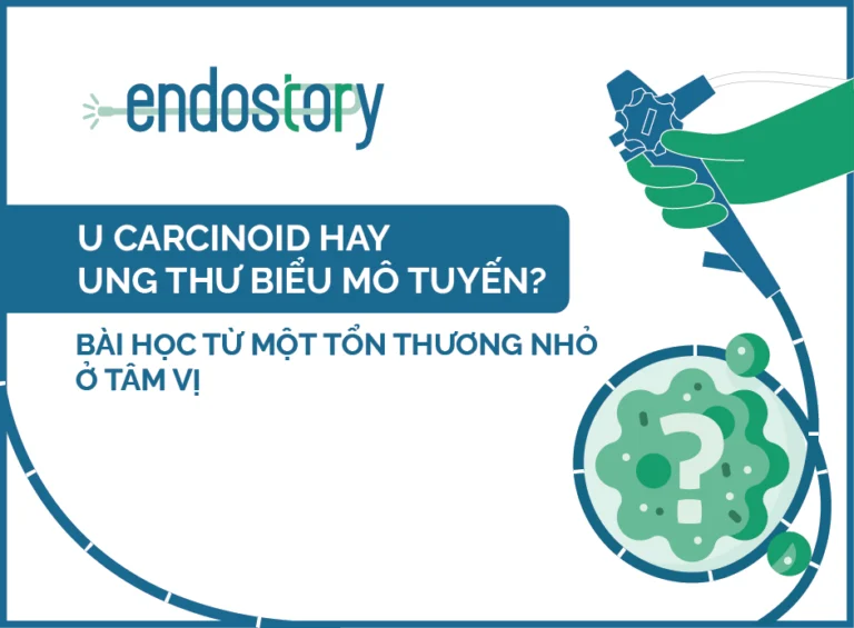 Endostory No.17: U carcinoid hay ung thư biểu mô tuyến? Bài học từ một tổn thương nhỏ ở tâm vị