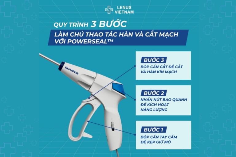 Three-Step Workflow for Precise Vessel Sealing and Transection with PowerSeal™