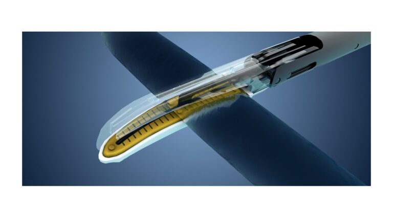 Choosing an electrosurgical device in modern surgery: key considerations for surgeons